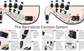 Bannatyne Canister System